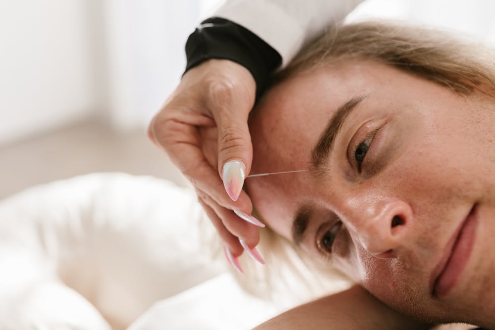 Exploring the Benefits of Acupuncture for Pain Management and Beyond